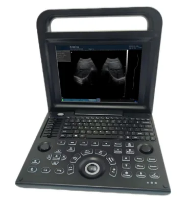 HEALICOM HBW-4P ultrasound machine