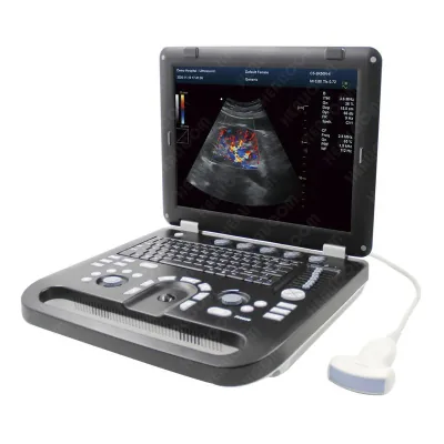 HEALICOM HUC-560 ultrasound machine