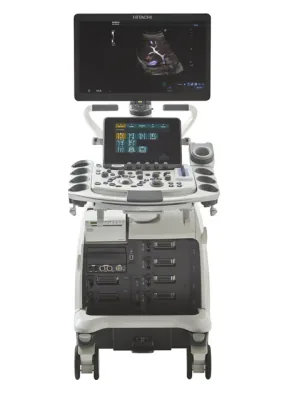 HITACHI ARIETTA 850 ultrasound machine