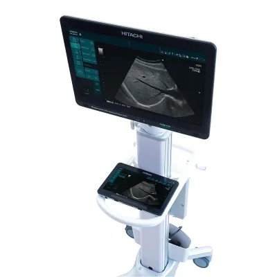 HITACHI ARIETTA Precision ultrasound machine