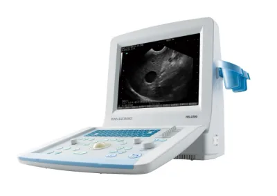 HONDA ELECTRONICS HS-2200 ultrasound machine