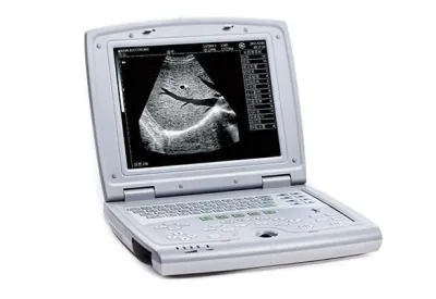 KAIXIN KX5000 ultrasound machine