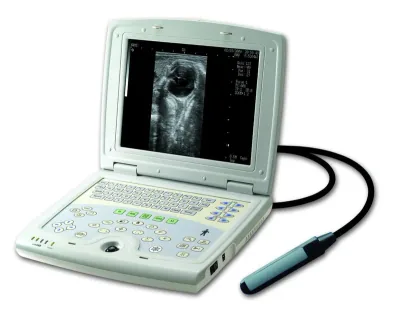 KAIXIN KX5000V ultrasound machine