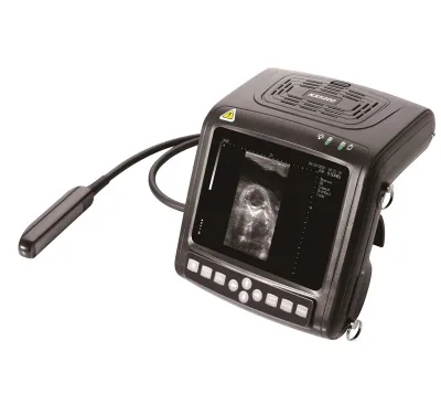 KAIXIN KX5200V ultrasound machine