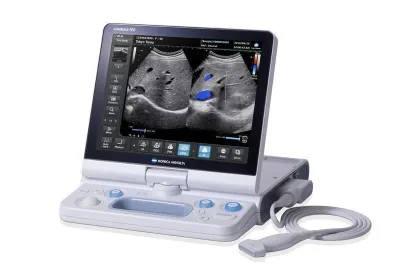 KONICA MINOLTA Sonimage HS1 ultrasound machine