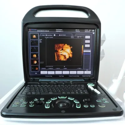 KONTED C9 PLUS (3D/4D) ultrasound machine