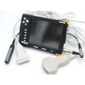 KONTED V10 ultrasound machine