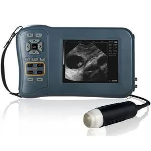 KONTED V5 ultrasound machine