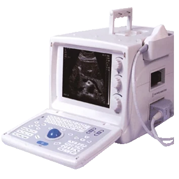 LANDWIND C20 ultrasound machine