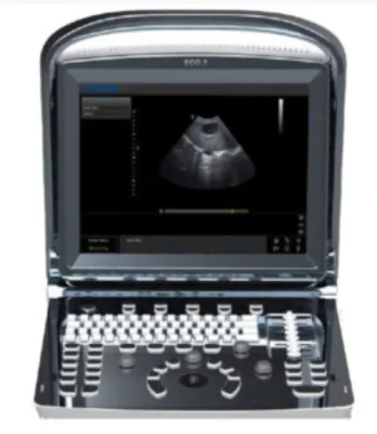 MEDGYN Eco 3 ultrasound machine