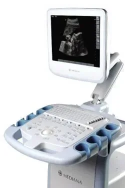 MEDIANA SmartSono MS-09 ultrasound machine