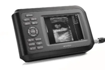 MEDITECH Sono R ultrasound machine