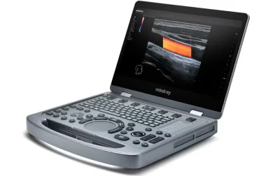 MINDRAY MX3 ultrasound machine
