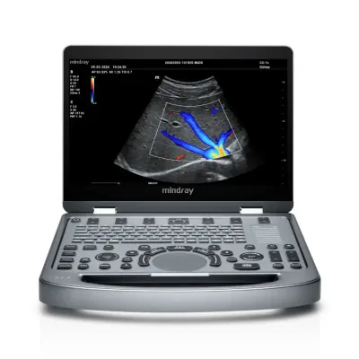 MINDRAY MX5 ultrasound machine