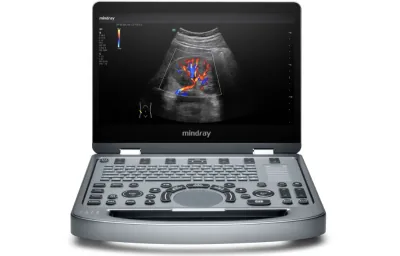 MINDRAY MX6 ultrasound machine