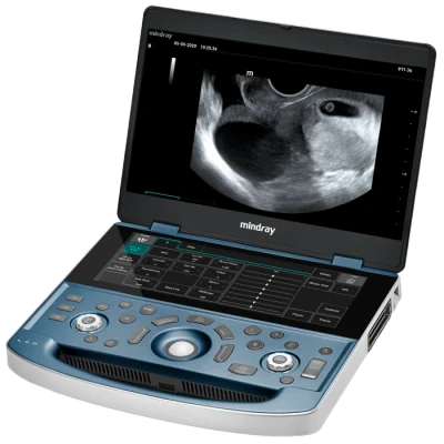 MINDRAY MX8 ultrasound machine