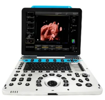MSL MSLCU35 ultrasound machine
