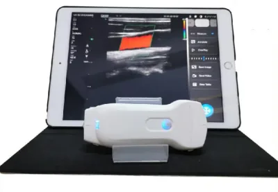 MSL MSLPU80 ultrasound machine