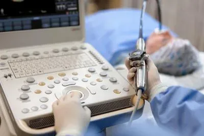 PHILIPS CX50 ultrasound machine