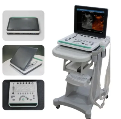 QZ QZ-S2 ultrasound machine
