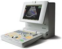 SAMSUNG SonoAce Pico ultrasound machine