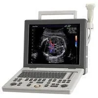 SAMSUNG SonoAce R3 ultrasound machine