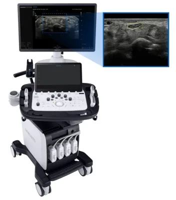 SAMSUNG V8 ultrasound machine