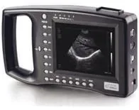SCHIPPERS Multiskan ultrasound machine