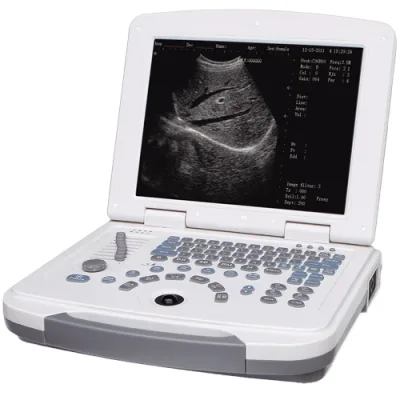 SHANGHAI MEDECO ME-500 ultrasound machine