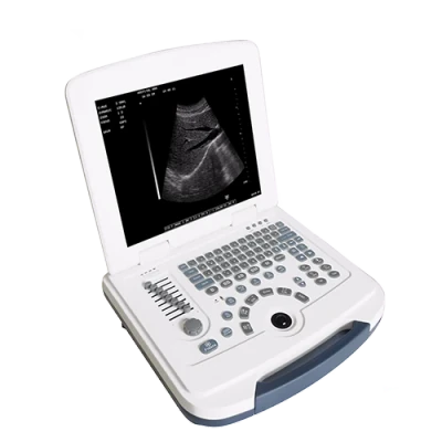 SHANGHAI MEDECO ME-580 ultrasound machine