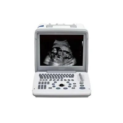 SHENZHEN SHIMAI MEDICAL M30 ultrasound machine