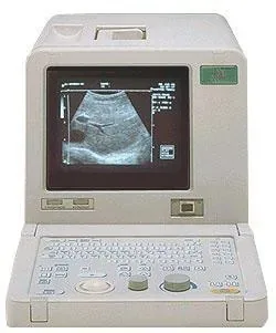 SHIMADZU SDU-350XL ultrasound machine