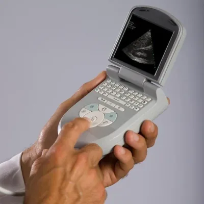 SIEMENS ACUSON P10 ultrasound machine