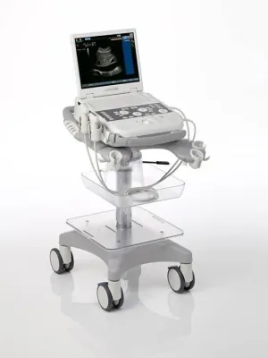 SIEMENS ACUSON P300 ultrasound machine