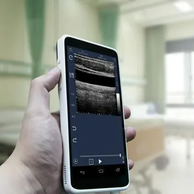 SIFSOF SIFULTRAS-5.55 ultrasound machine