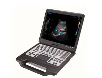 SIUI Apogee 1000 Lite ultrasound machine