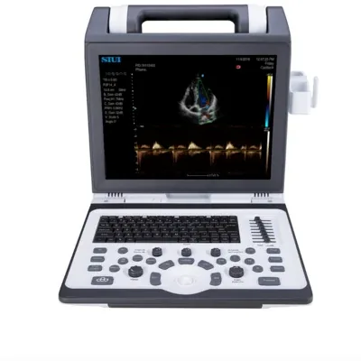 SIUI Apogee 1100 ultrasound machine