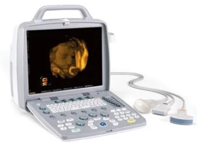 SIUI Apogee 1200 Touch ultrasound machine