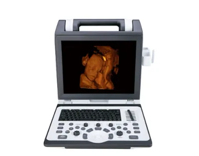 SIUI Apogee 2100 ultrasound machine