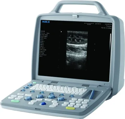 SIUI CTS-6600V Plus ultrasound machine