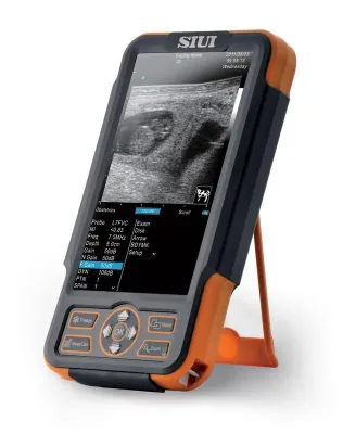 SIUI CTS-800 ultrasound machine