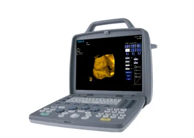 SIUI CTS-8800 Plus ultrasound machine