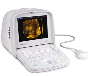 SIUI CTS-8800V ultrasound machine