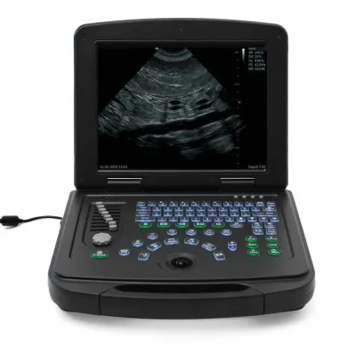 SMARTBREEDER SmartBook HD ultrasound machine