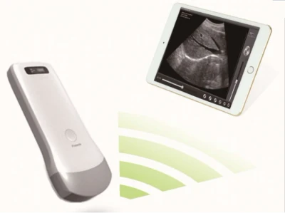 SONOPTEK B Scan SS-1 ultrasound machine