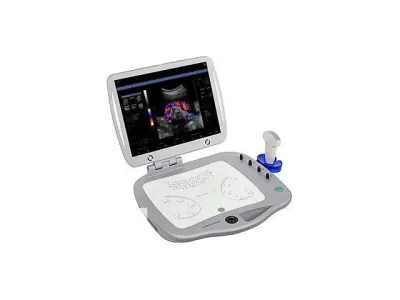 SONOSCANNER Orcheo Lite ultrasound machine