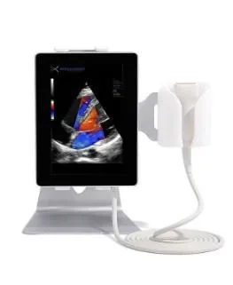 SONOSCANNER U-Lite EXP ultrasound machine
