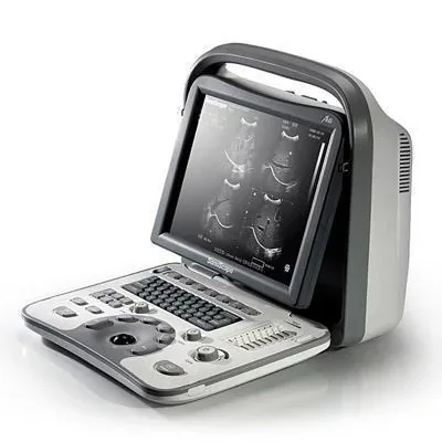 SONOSCAPE A6 ultrasound machine