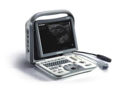 SONOSCAPE A6V ultrasound machine