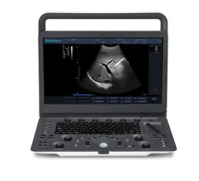 SONOSCAPE E1 ultrasound machine